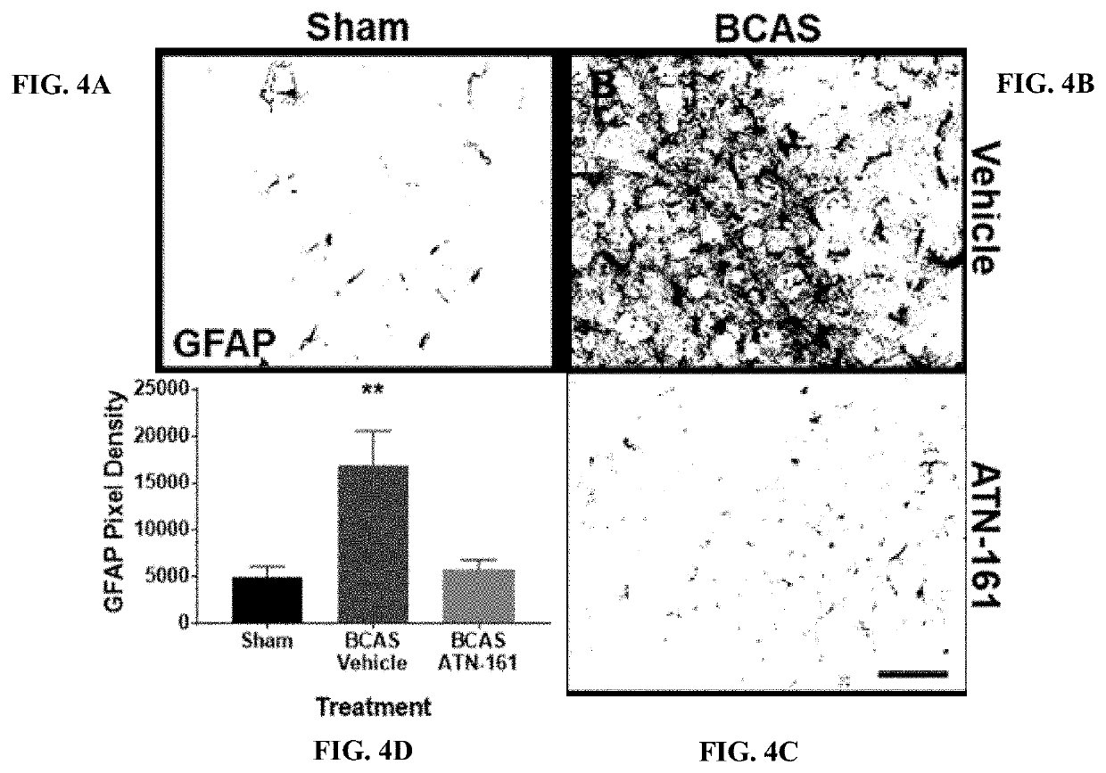 Inhibition of alpha5beta1 integrin with atn-161 as a novel therapy for vascular dementia