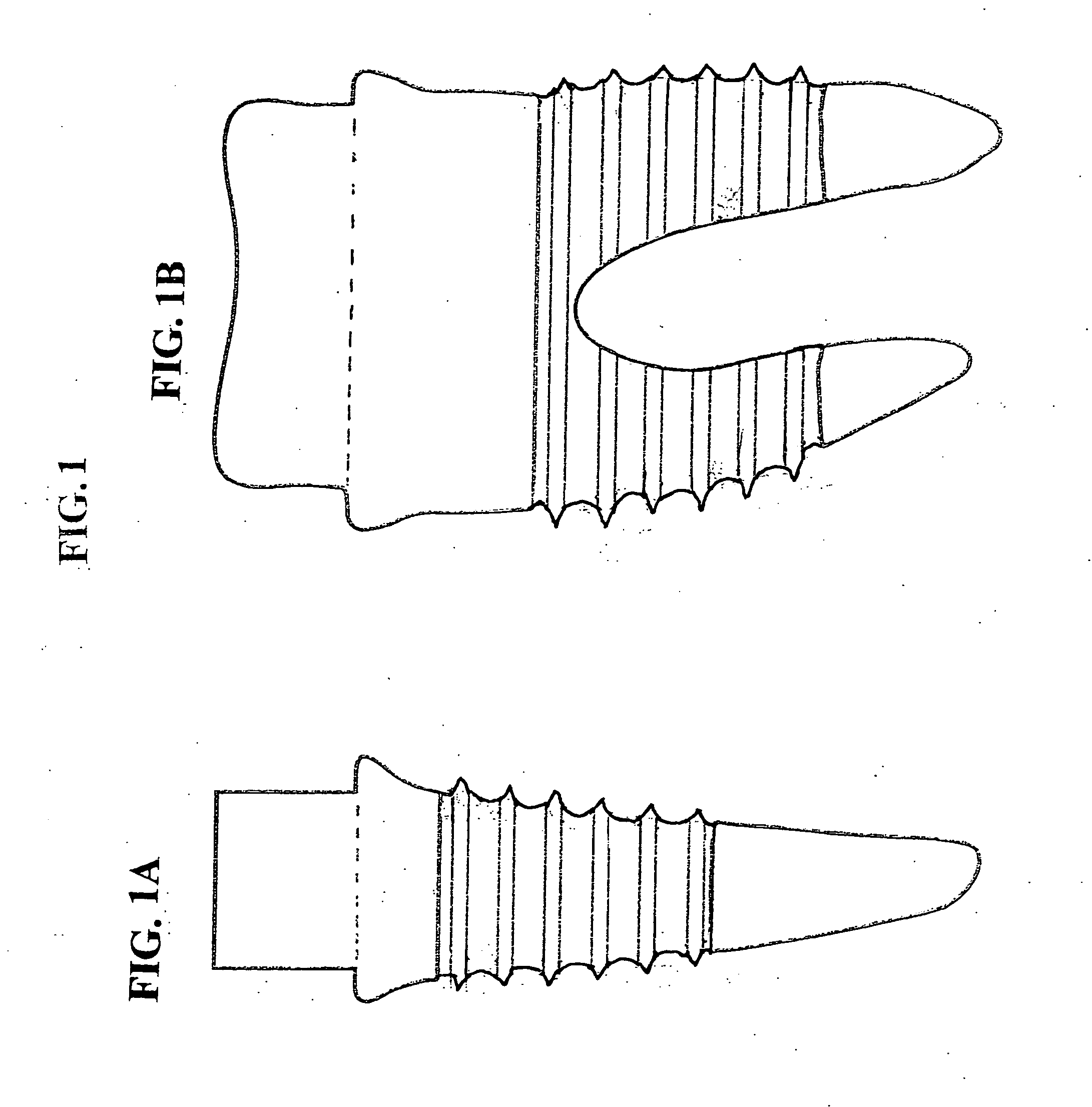 Individualized endosseous dental implant