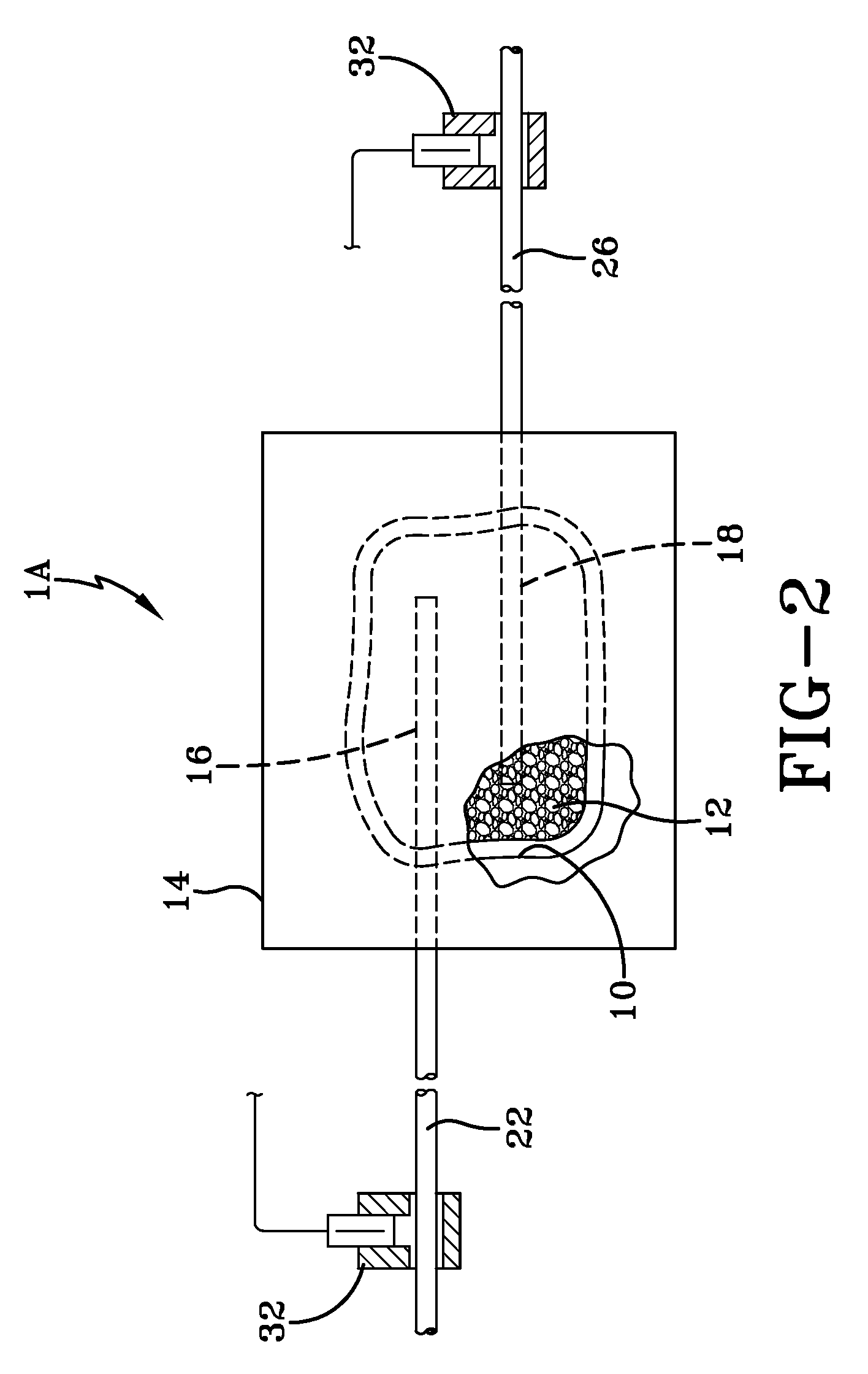 Wound care vacuum bandaging in combination with acoustic shock wave applications