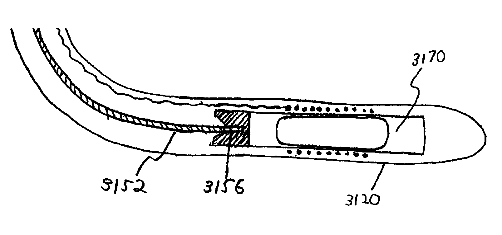 Implantable Micro-Generator Devices with Optimized Configuration, Methods of Use, Systems and Kits Therefor