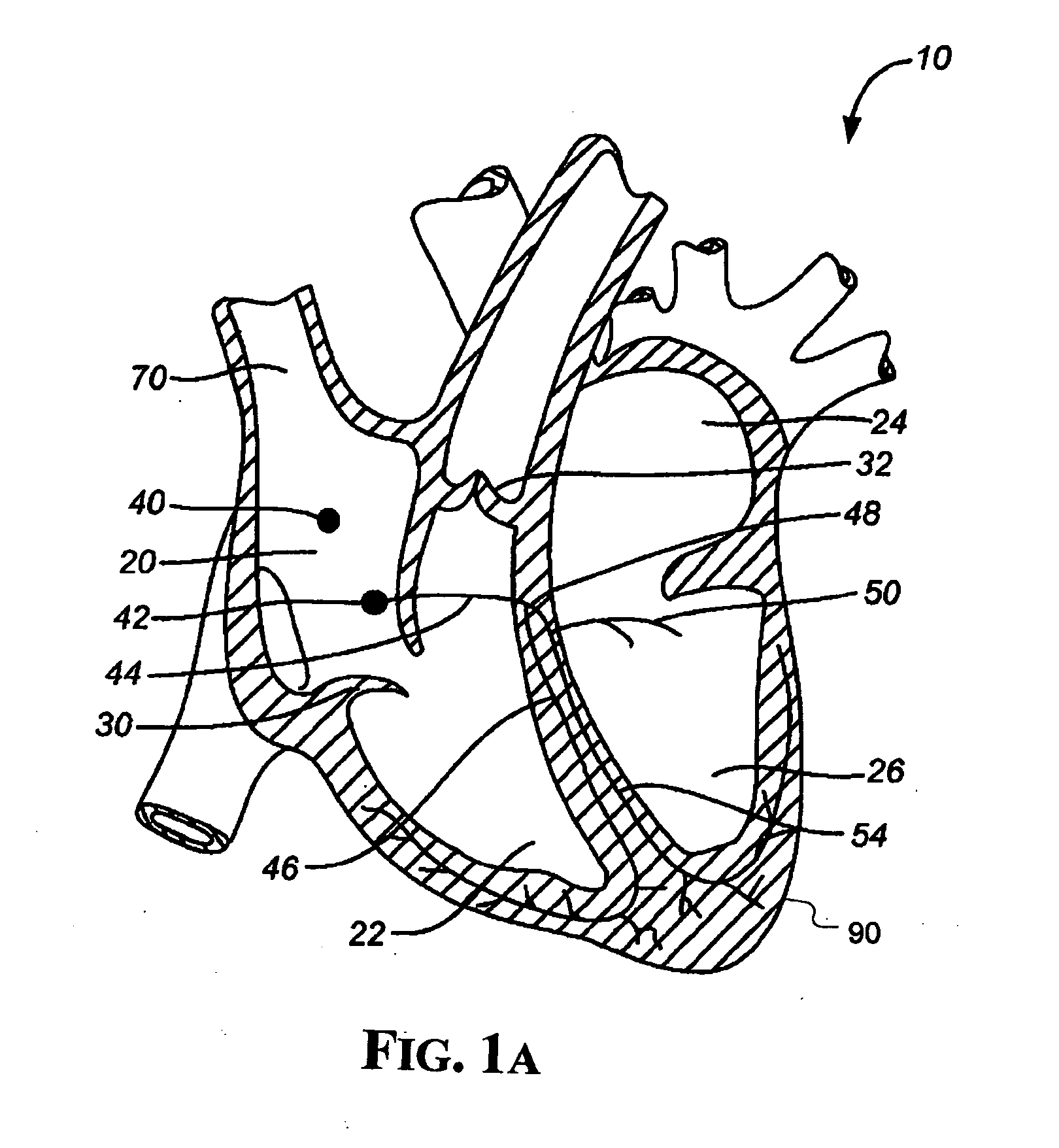 Implantable Micro-Generator Devices with Optimized Configuration, Methods of Use, Systems and Kits Therefor