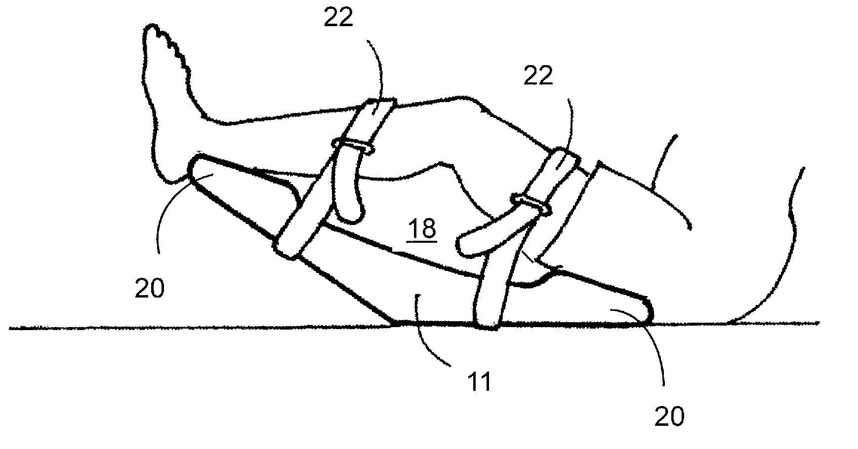 Methods and Devices for Treating Pathological Conditions of the Human Knee