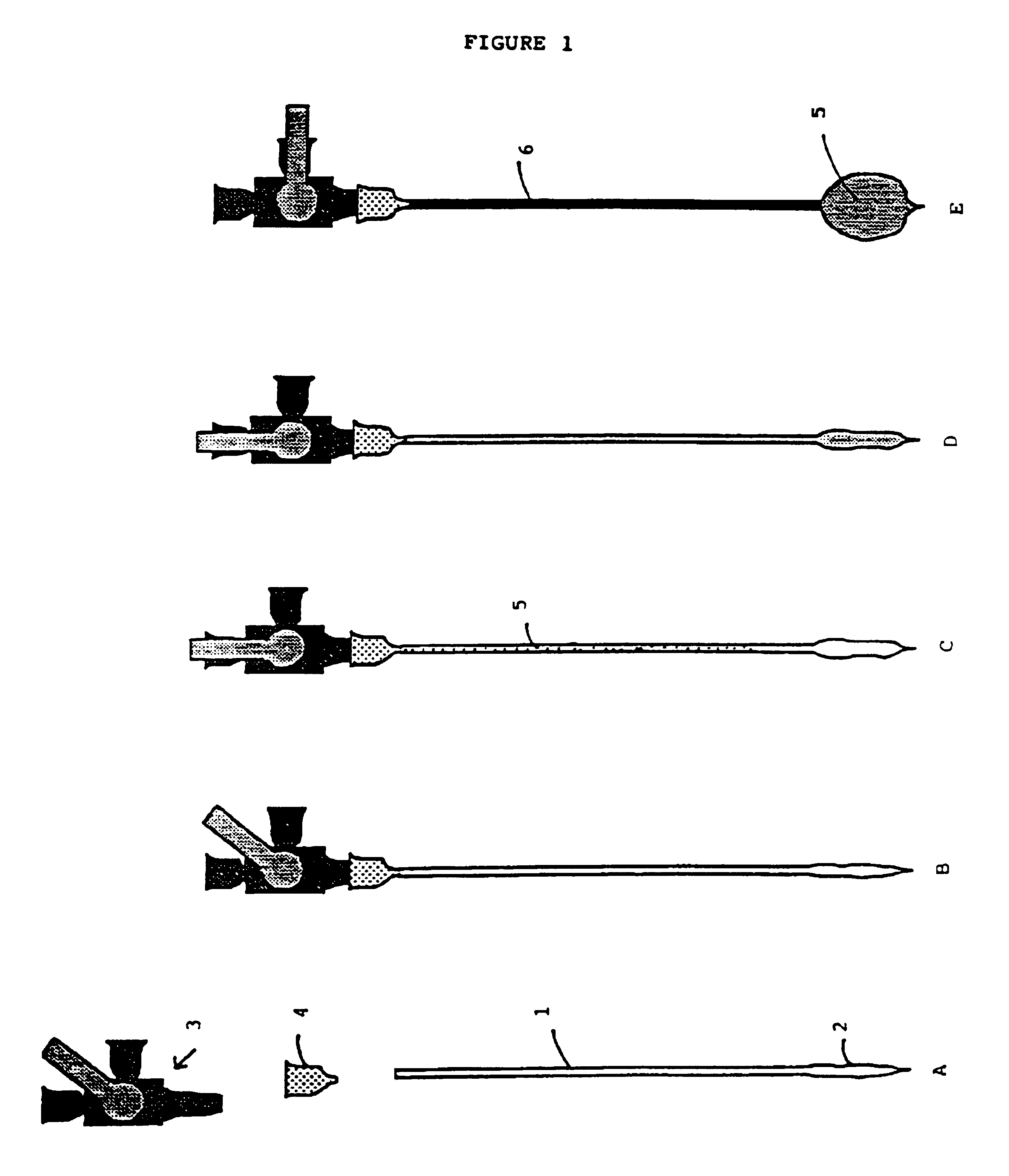 Compositions comprising a tissue glue and therapeutic agents