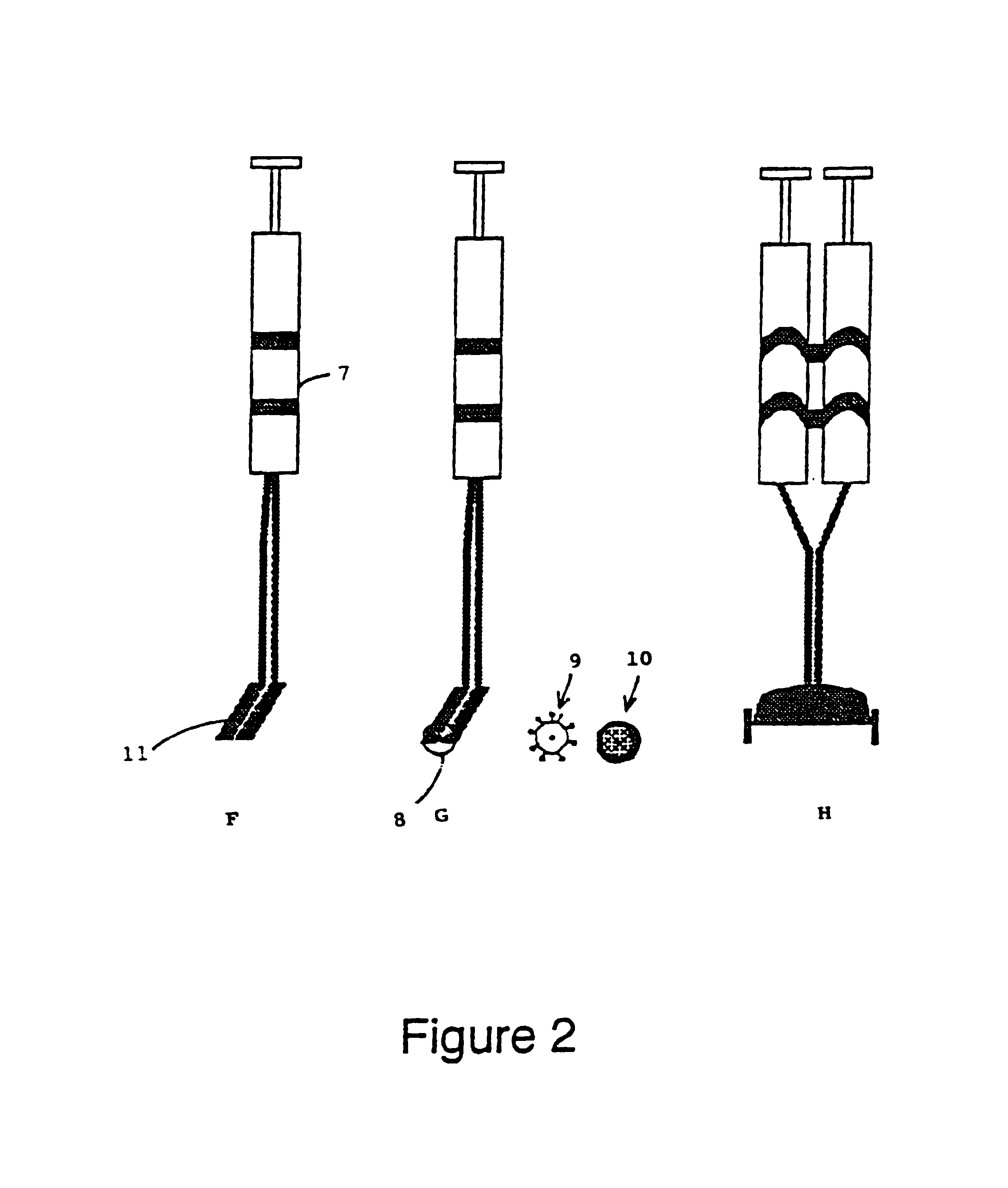 Compositions comprising a tissue glue and therapeutic agents