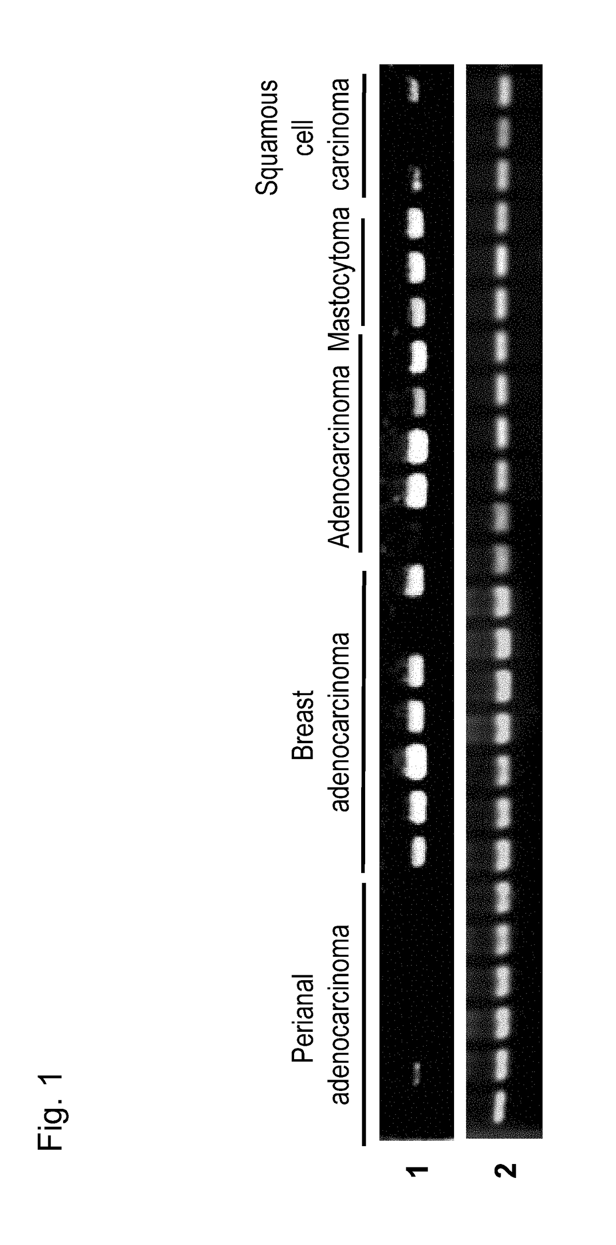 Pharmaceutical composition for treating and/or preventing cancer