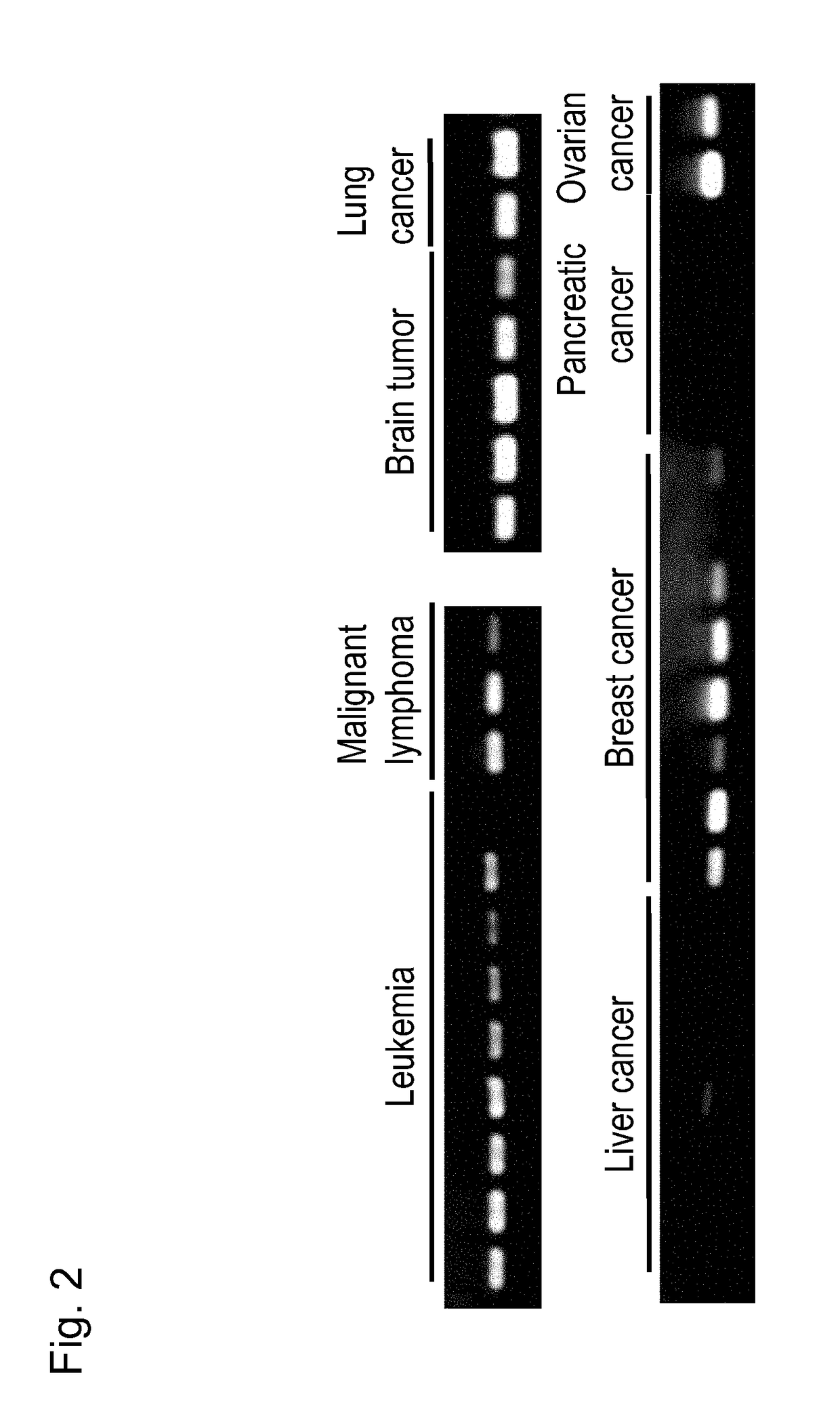 Pharmaceutical composition for treating and/or preventing cancer