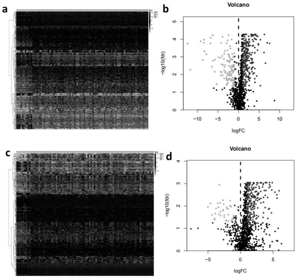 Application of group of immune-related molecular markers identified based on TCGA database in prognosis prediction of esophageal cancer