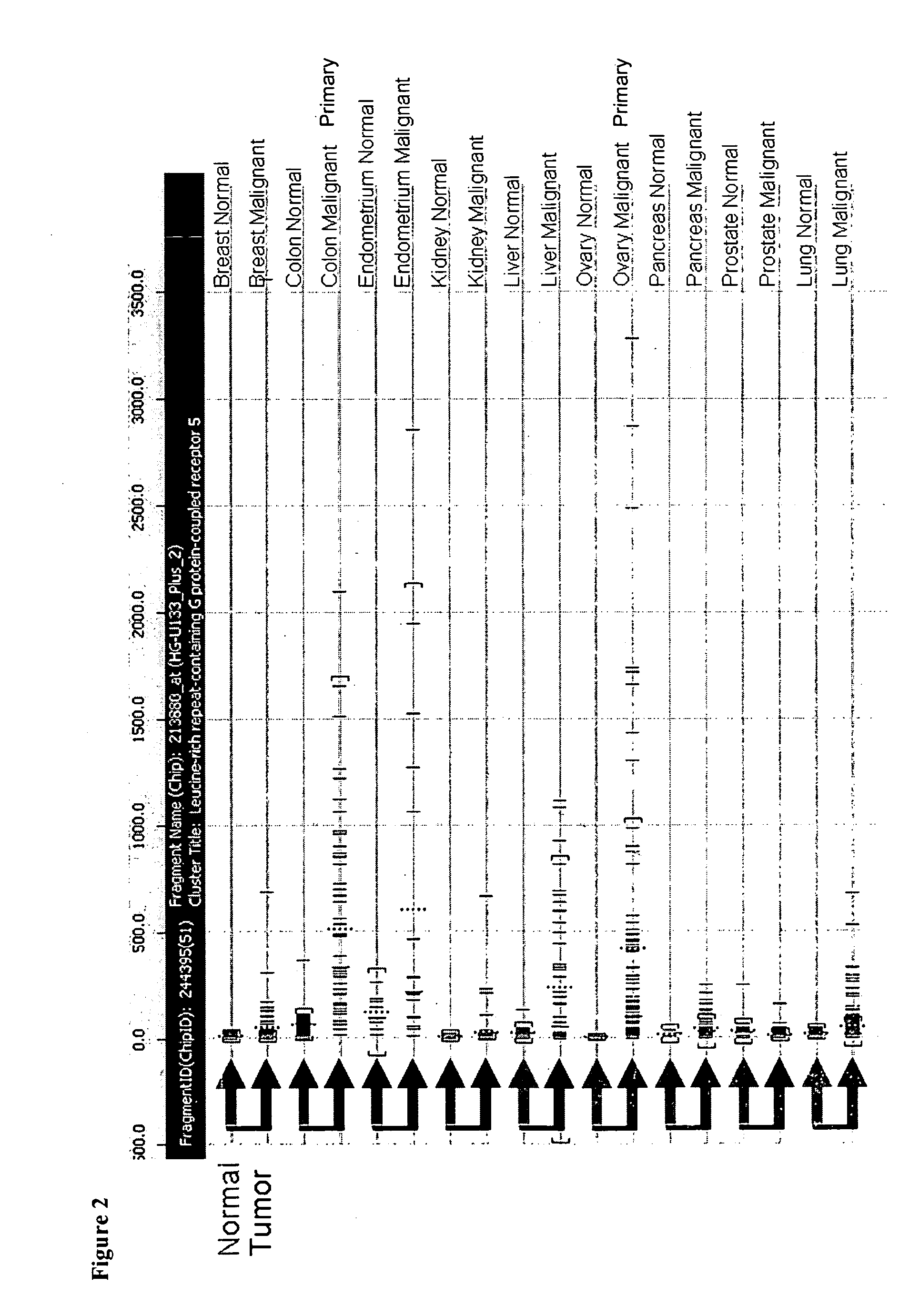 Compositions and Methods for Treating and Diagnosing Cancer