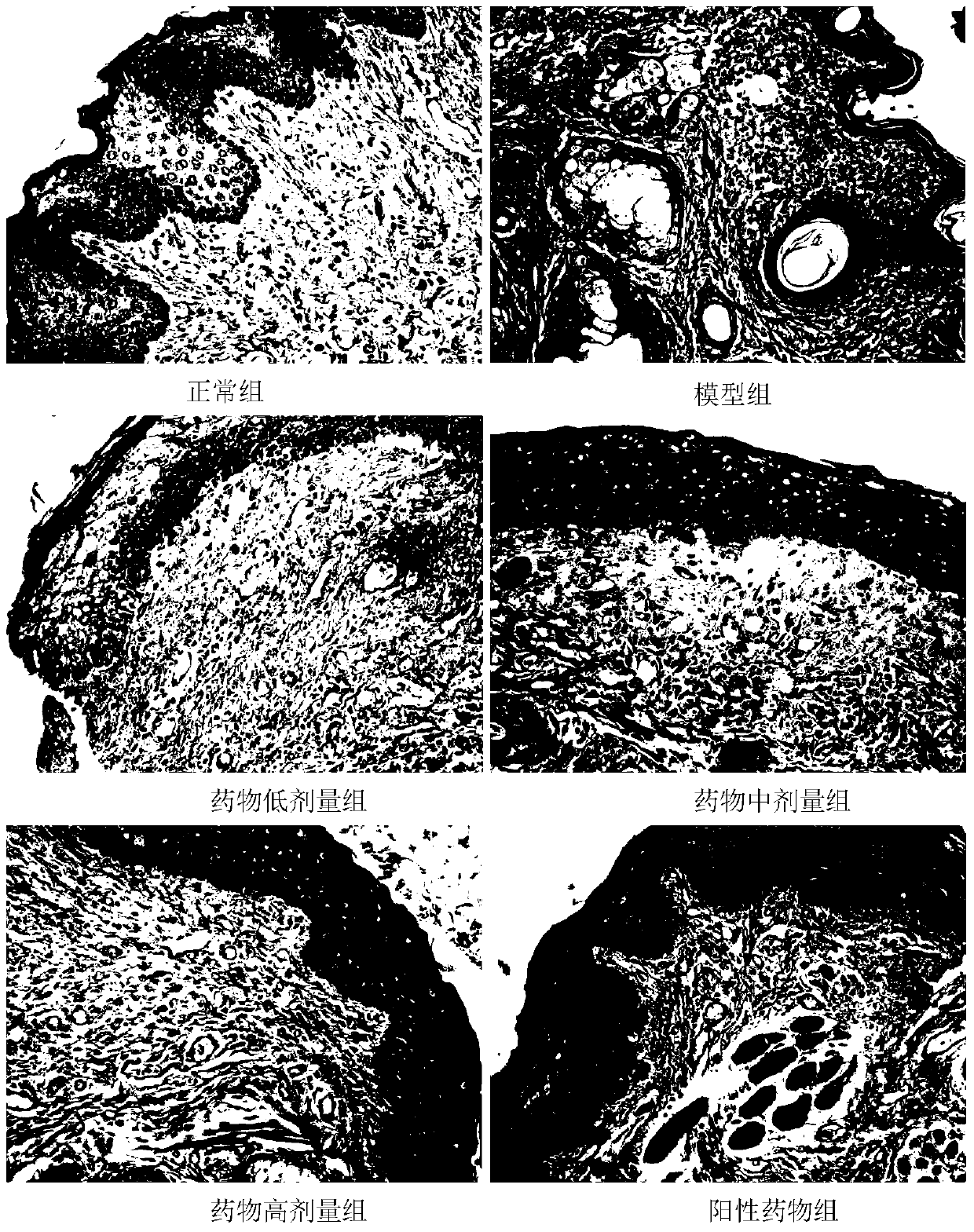 Application of a traditional Chinese medicine composition as preparation for treating oral ulcer