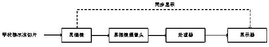 Thyroid frozen section diagnosis method and system