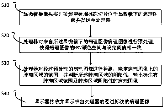 Thyroid frozen section diagnosis method and system