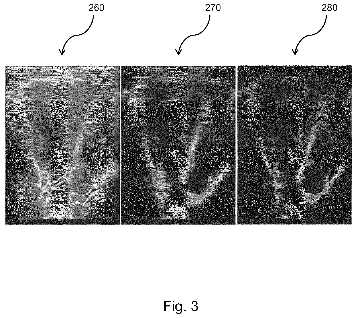 Methods and systems for processing an ultrasound image