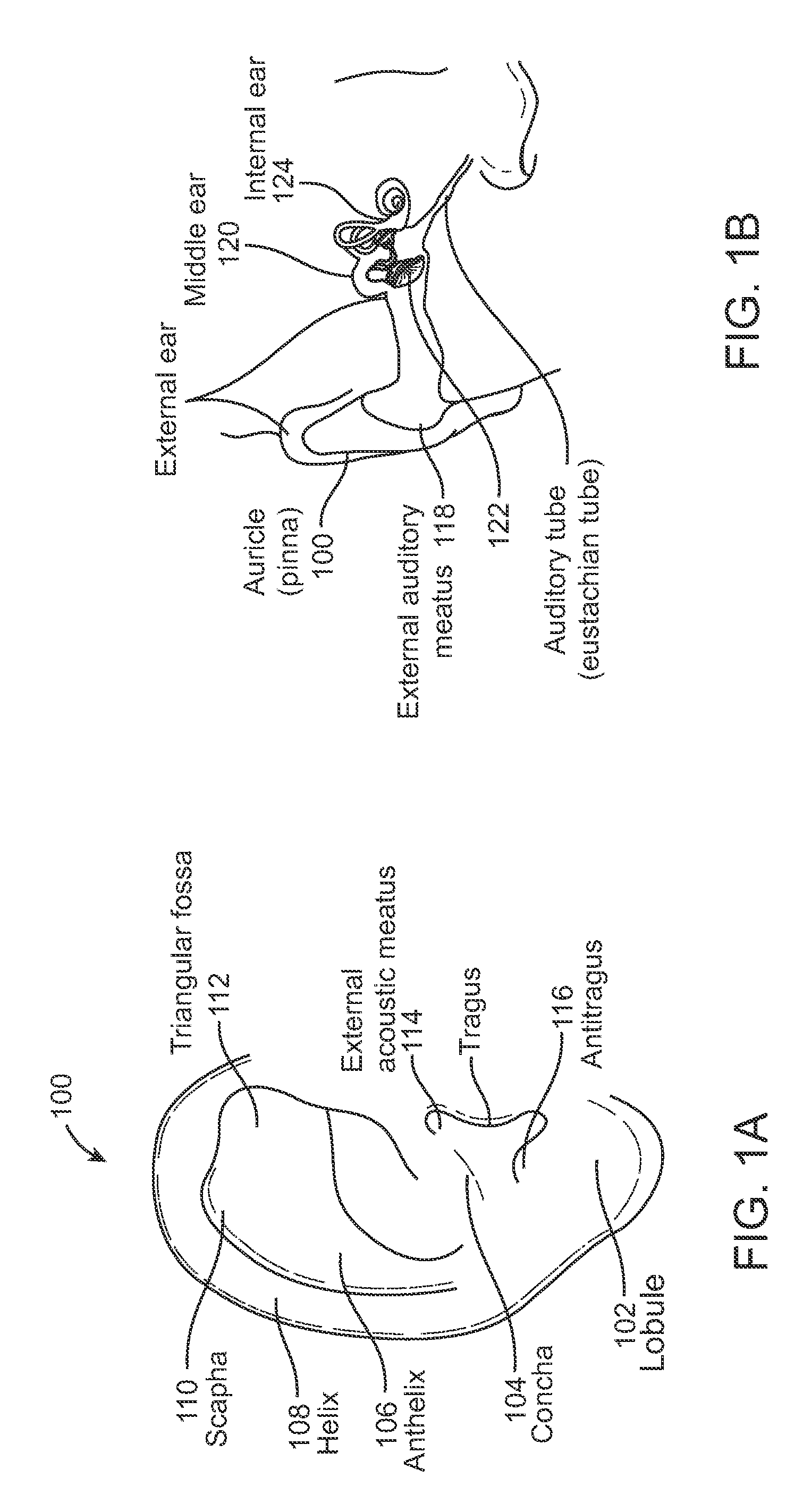 Systems and methods for anesthetizing ear tissue