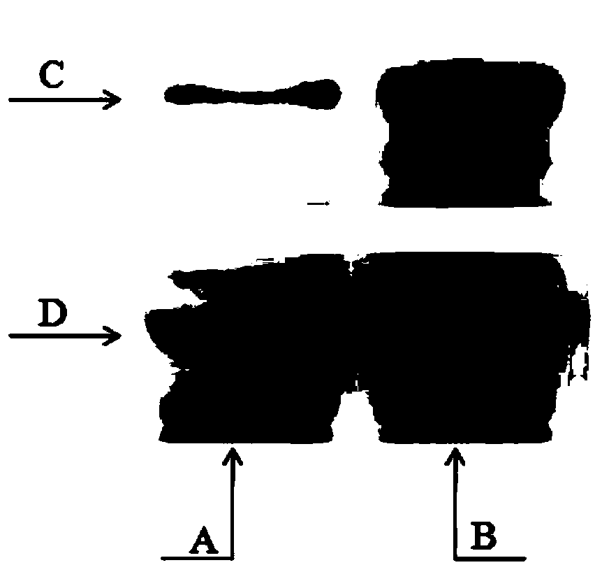 Application of gossypol acetate in pharmacy