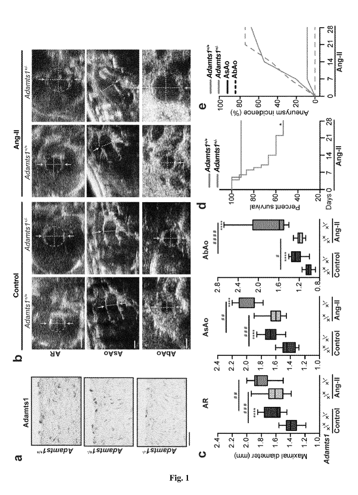 In vitro method for identifying thoracic aortic aneurysms (TAA) in a subject