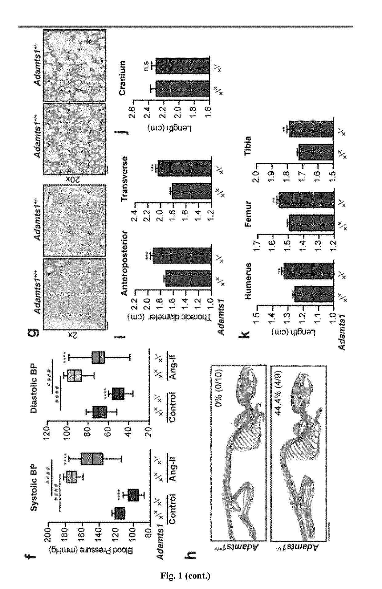 In vitro method for identifying thoracic aortic aneurysms (TAA) in a subject