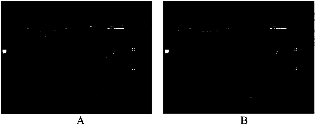 Identification method and device for training thyroid tumor ultrasonic image on line