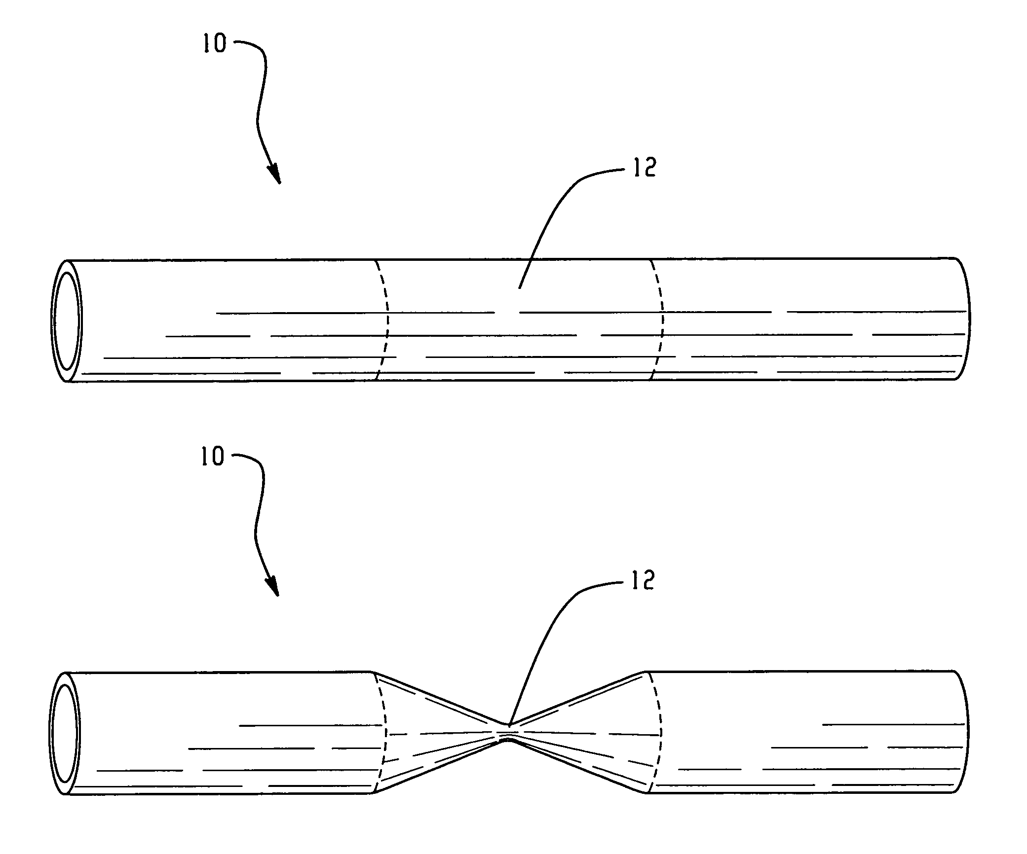 Shape memory polymer conduits and methods of use