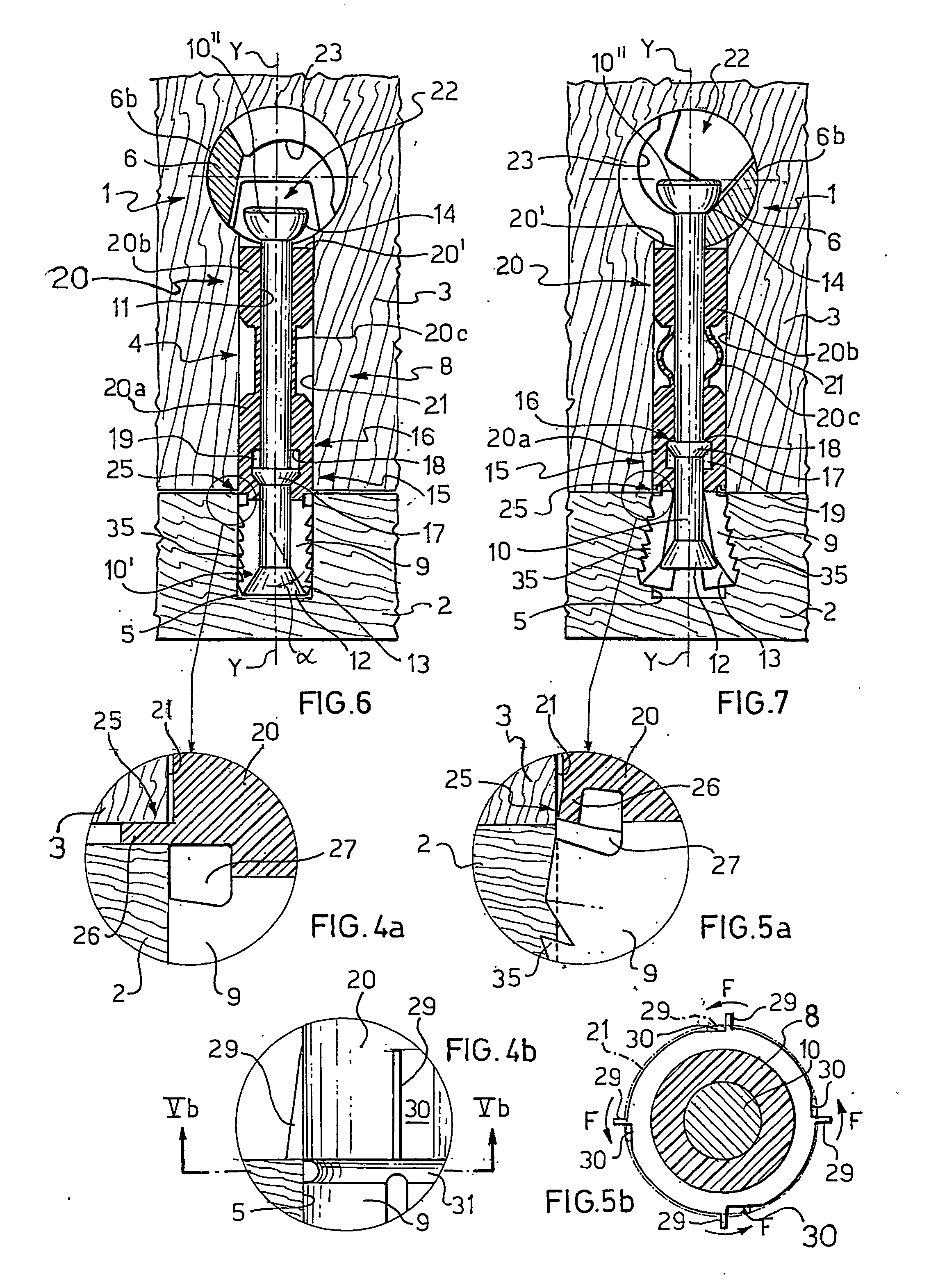 Device and method for detachably connecting abutting structural parts and tie member for use to form said device