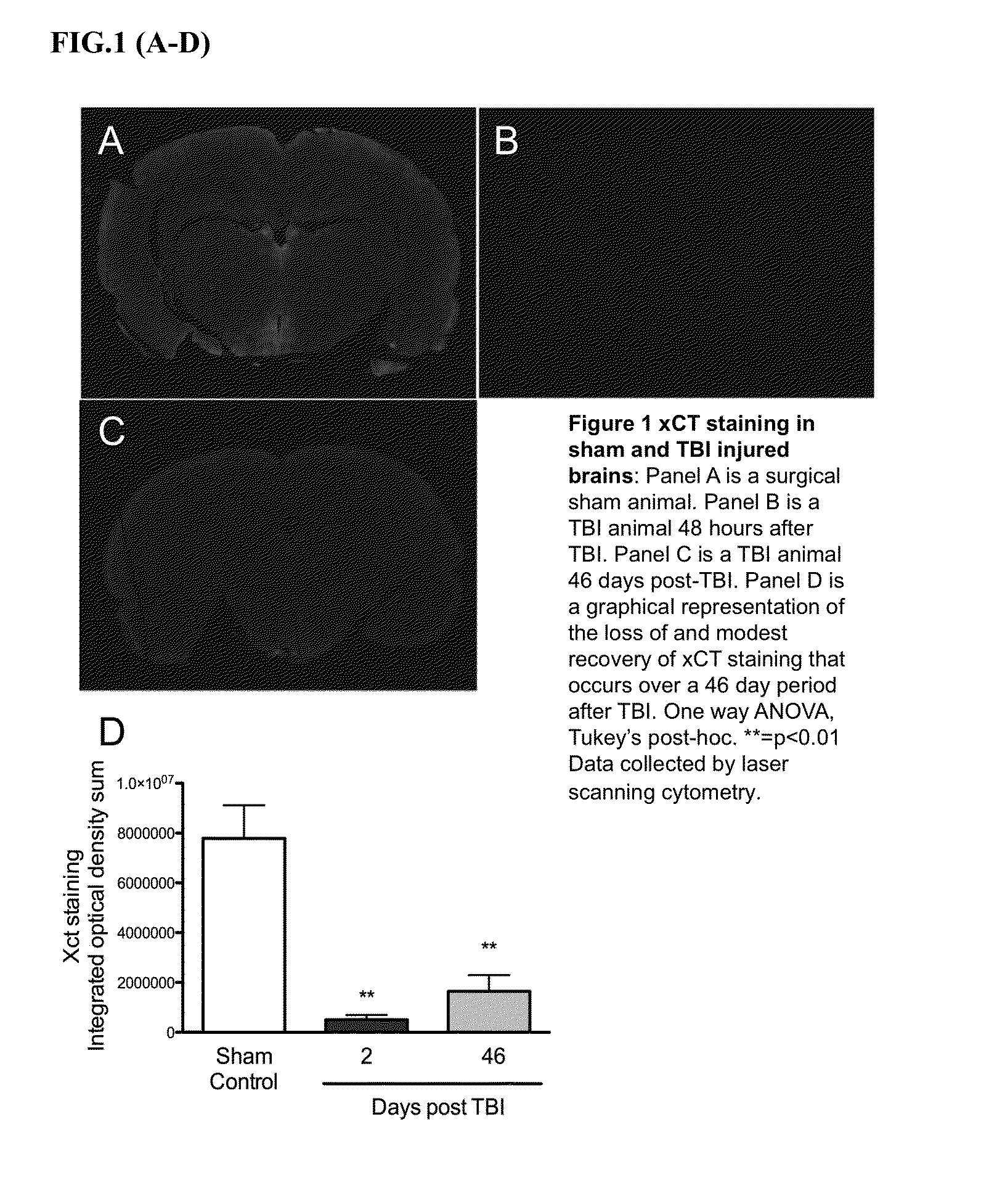 Detection of Brain Injury