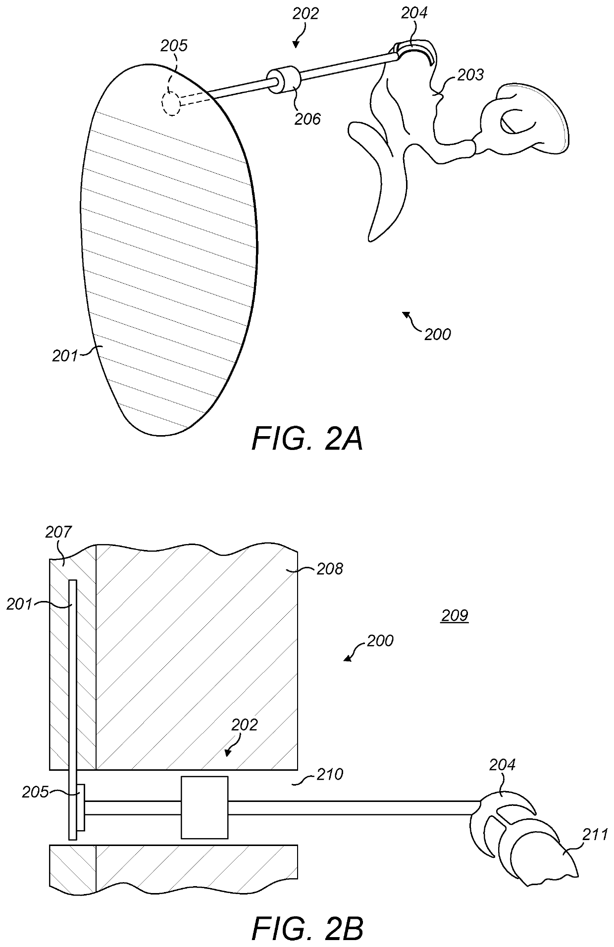 Universal Bone Conduction and Middle Ear Implant