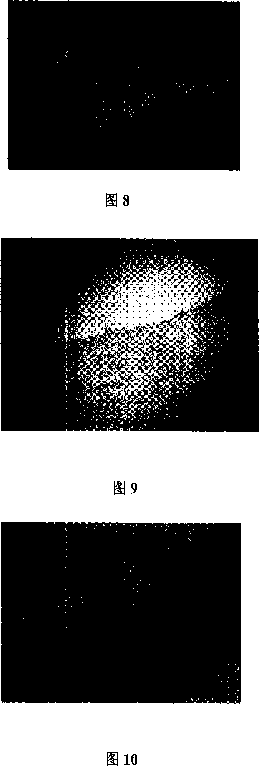 Preparation method of allogenic blood vessel decellularised scaffold