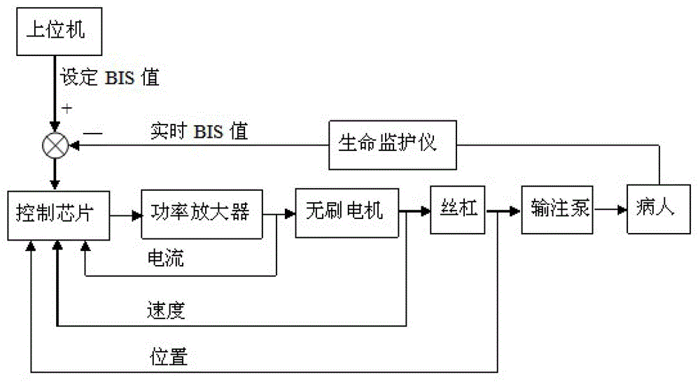 Anesthesia target-controlled infusion pump controller based on bis feedback