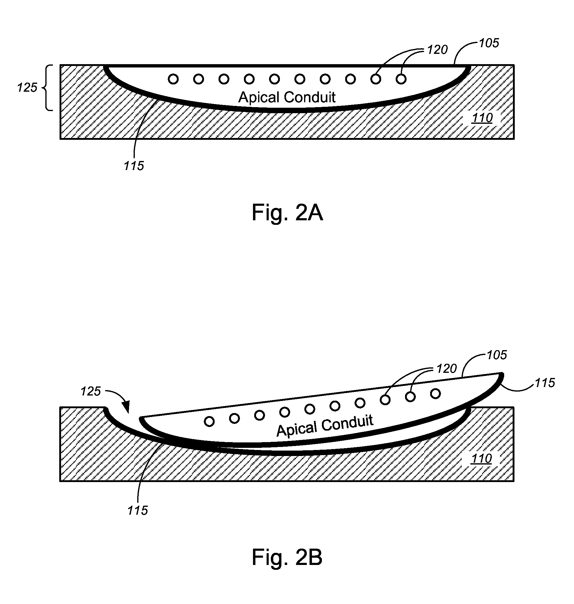 Apical Conduit and Methods of Using Same