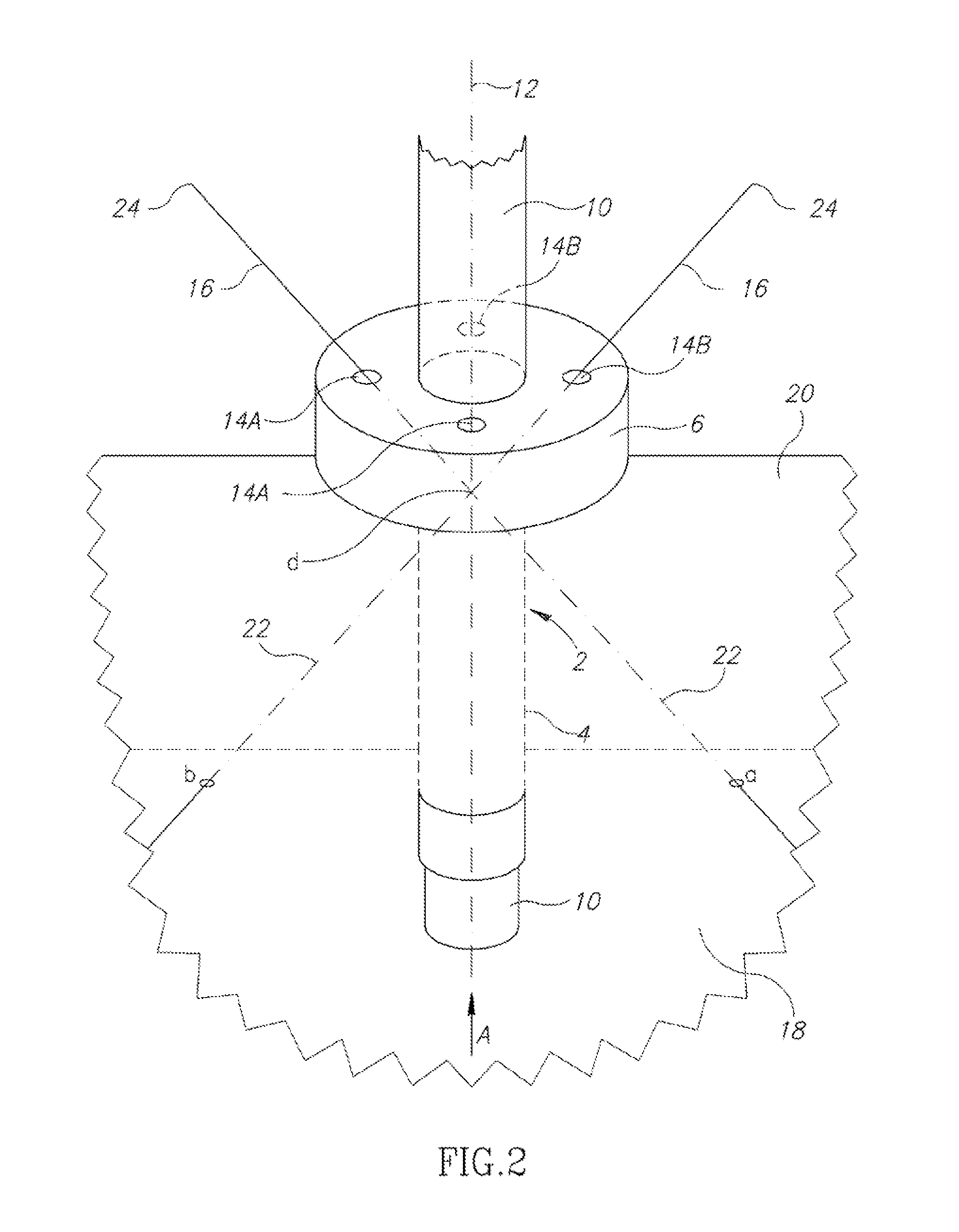 Device for wound suturing and hemostasis in the thoracic and the abdominal wall mainly in endoscopic operations