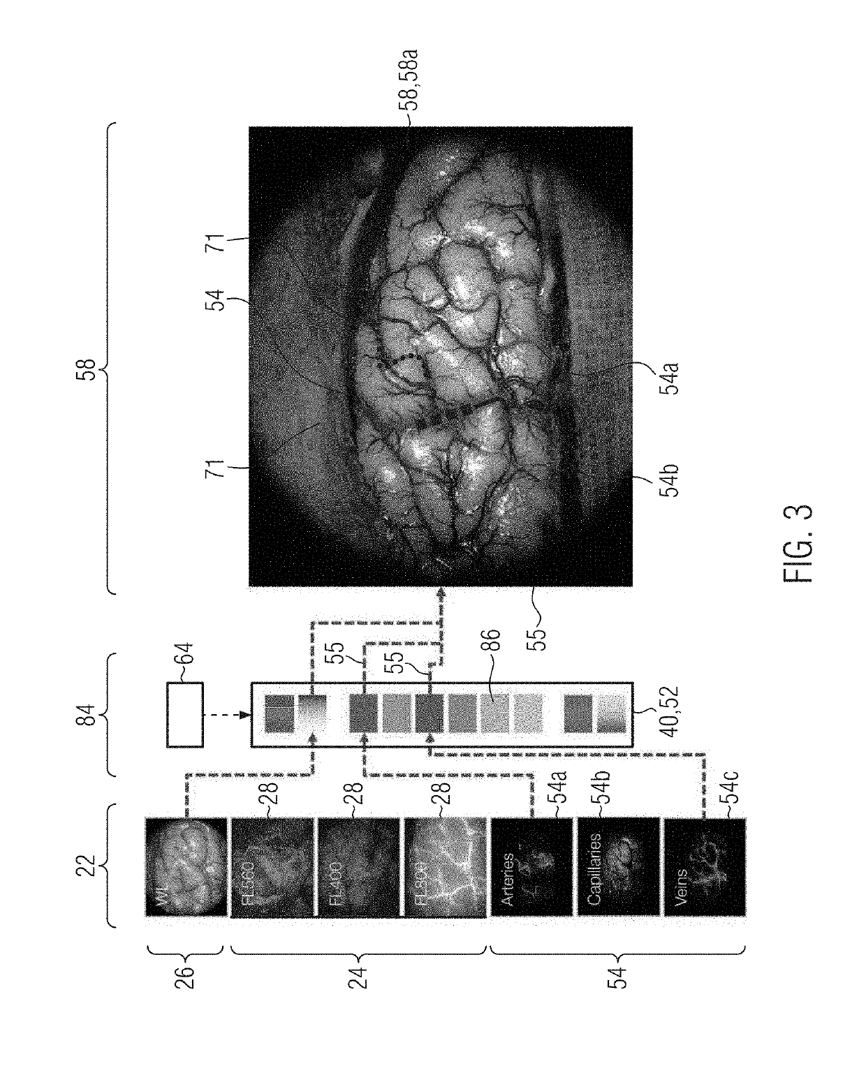 Augmented reality surgical microscope and microscopy method