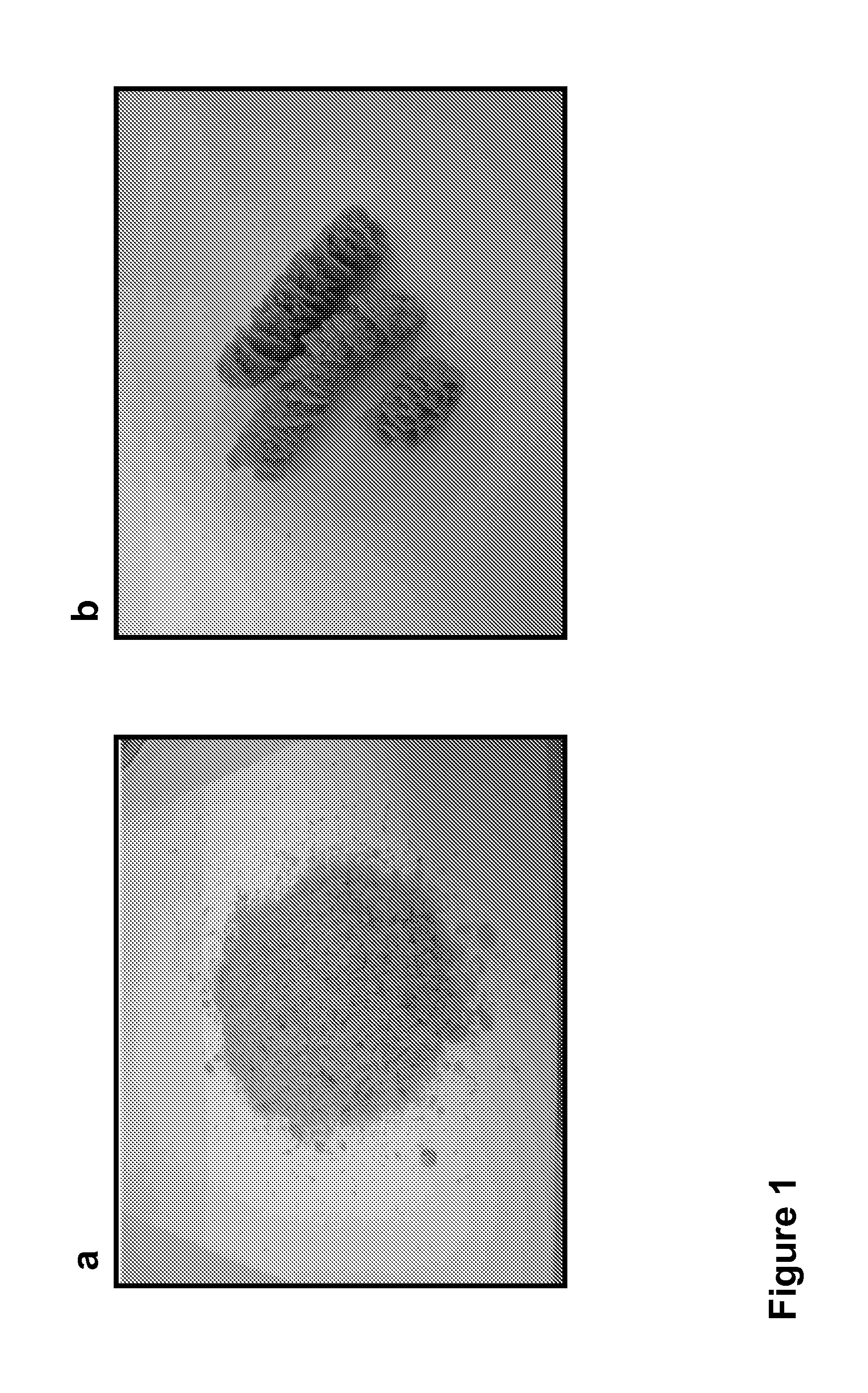 Methods of microbial oil extraction and separation