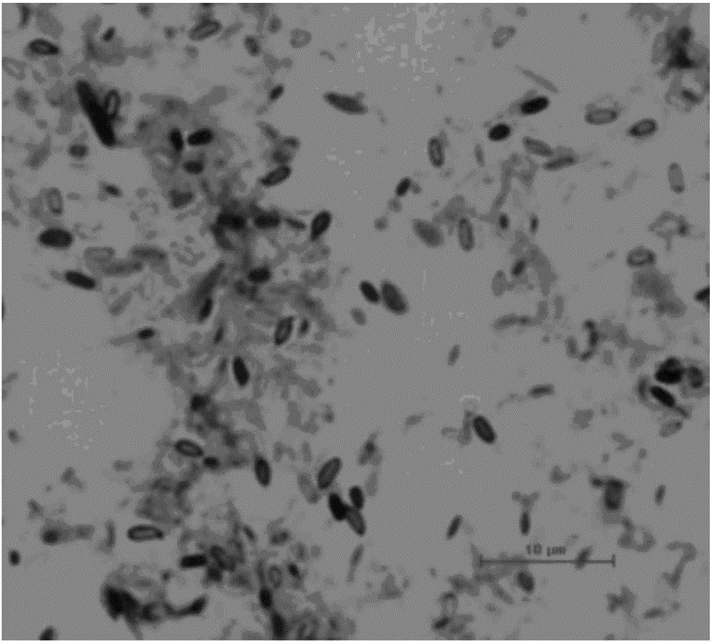 Bacillus licheniformis with high production of antimicrobial peptides and its application