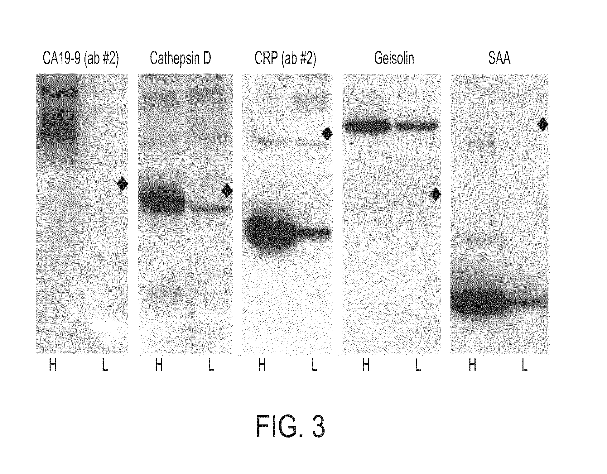 Biomarkers for pancreatic cancer and diagnostic methods