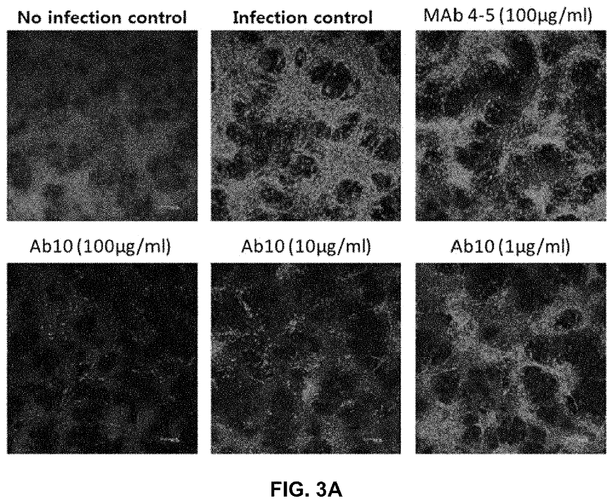 Antibody that binds to envelope glycoprotein of severe fever with thrombocytopenia syndrome virus and use for same