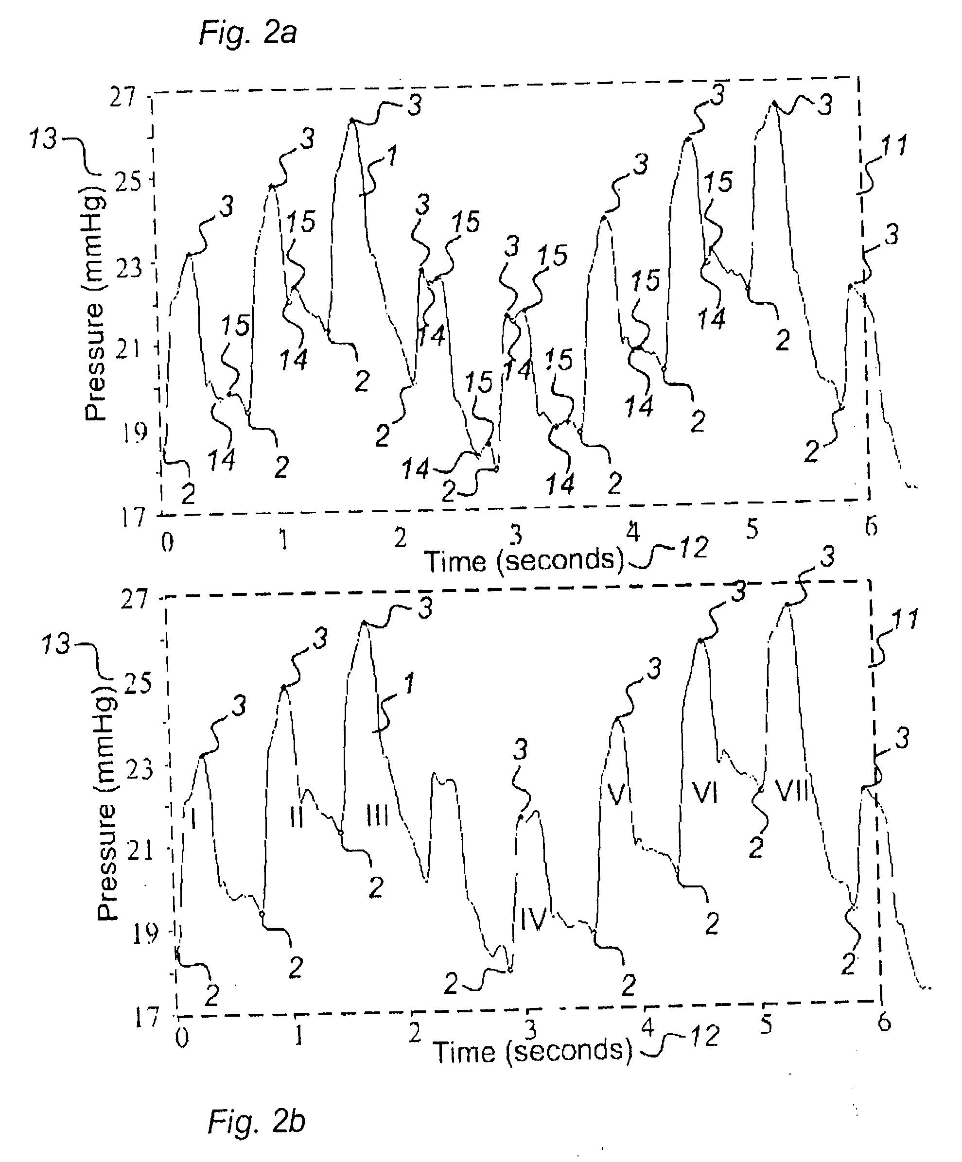 Method for analysis of single pulse pressure waves