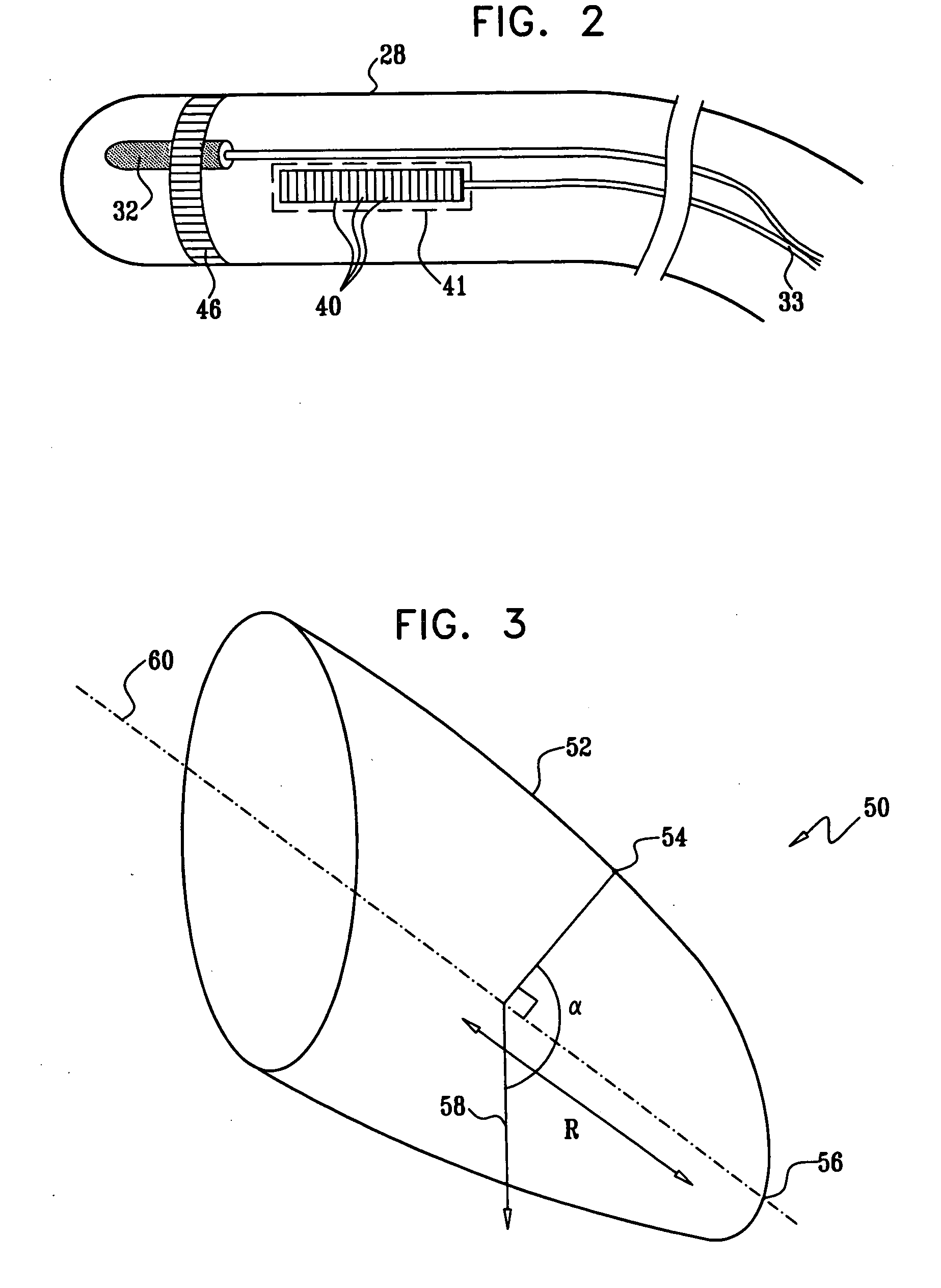 Synchronization of ultrasound imaging data with electrical mapping