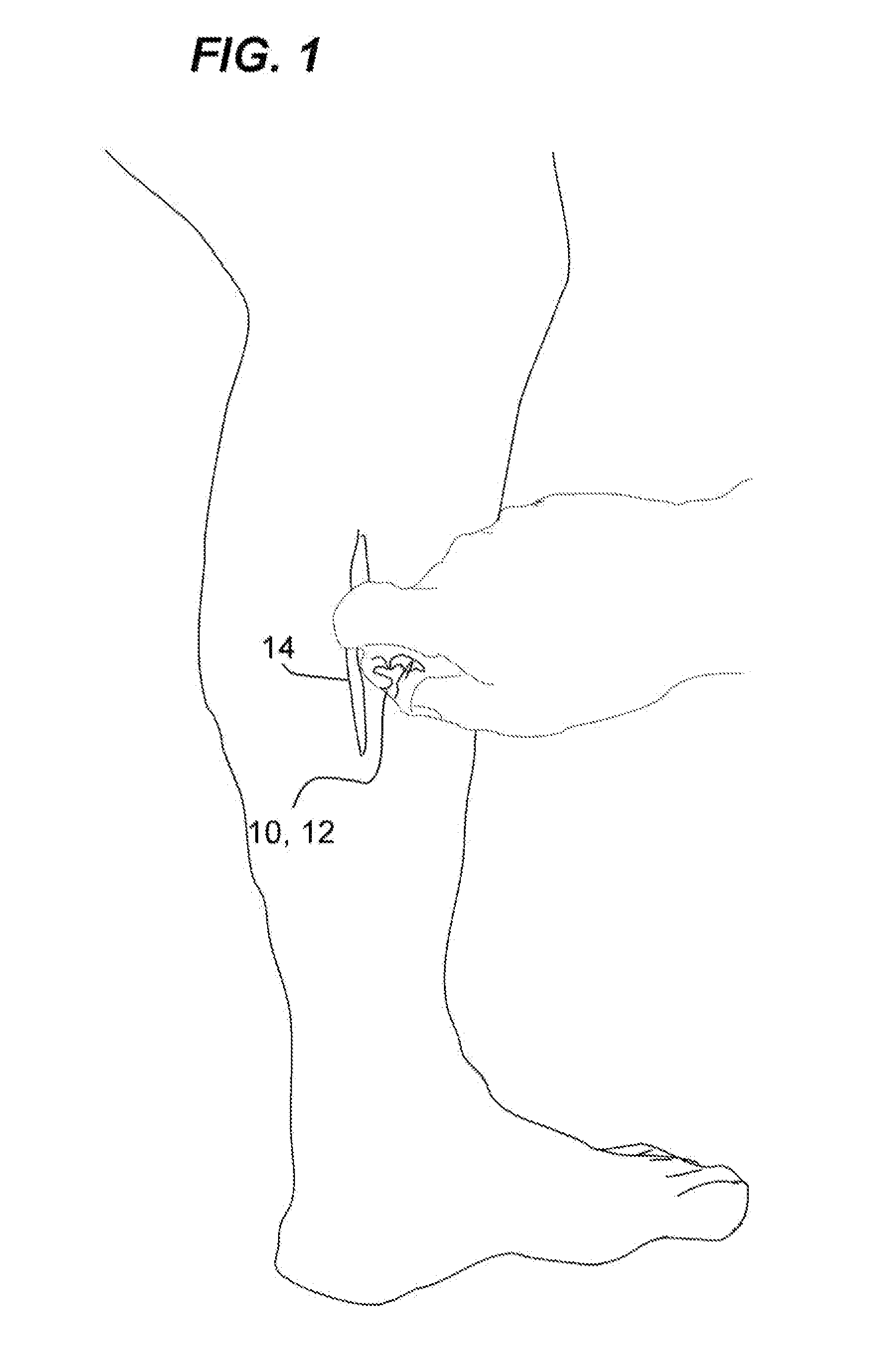 System and method for alleviating the appearance of scars and/or scar tissue