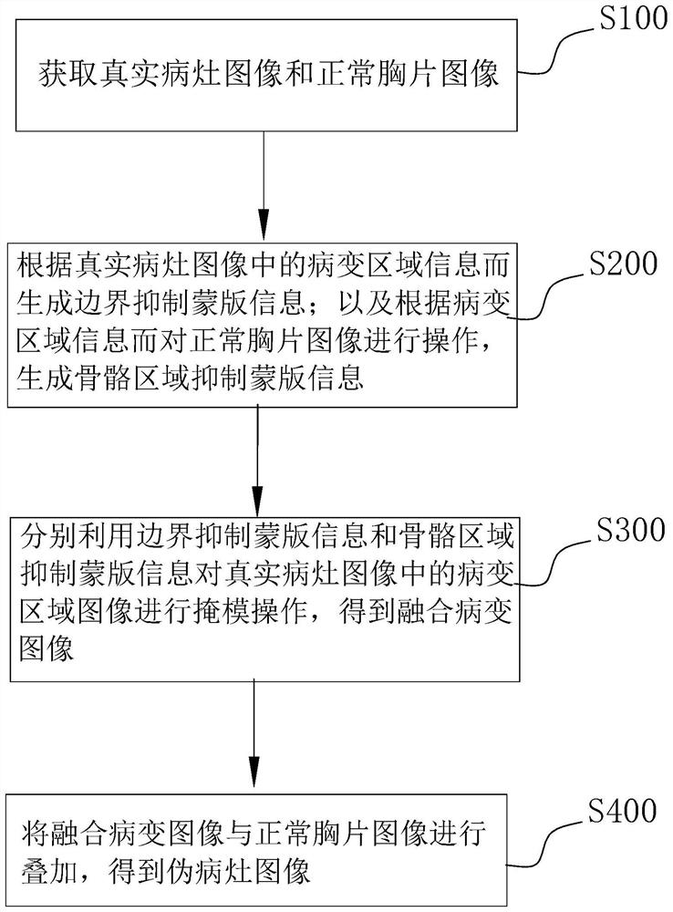 X-ray chest radiograph pseudo focus image generation method and device and storage medium