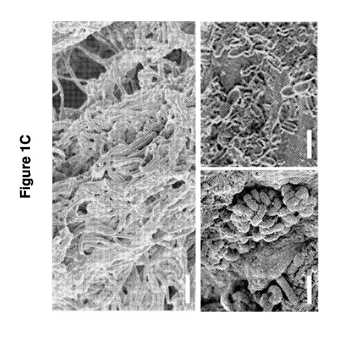 Biofilm formation to define risk for colon cancer