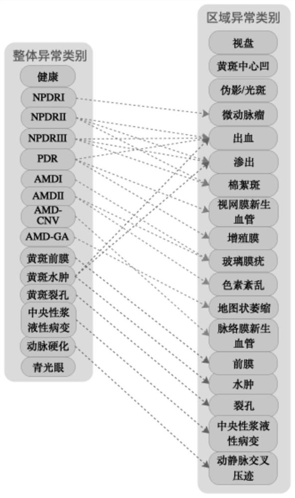 Retina anomaly analysis method and equipment