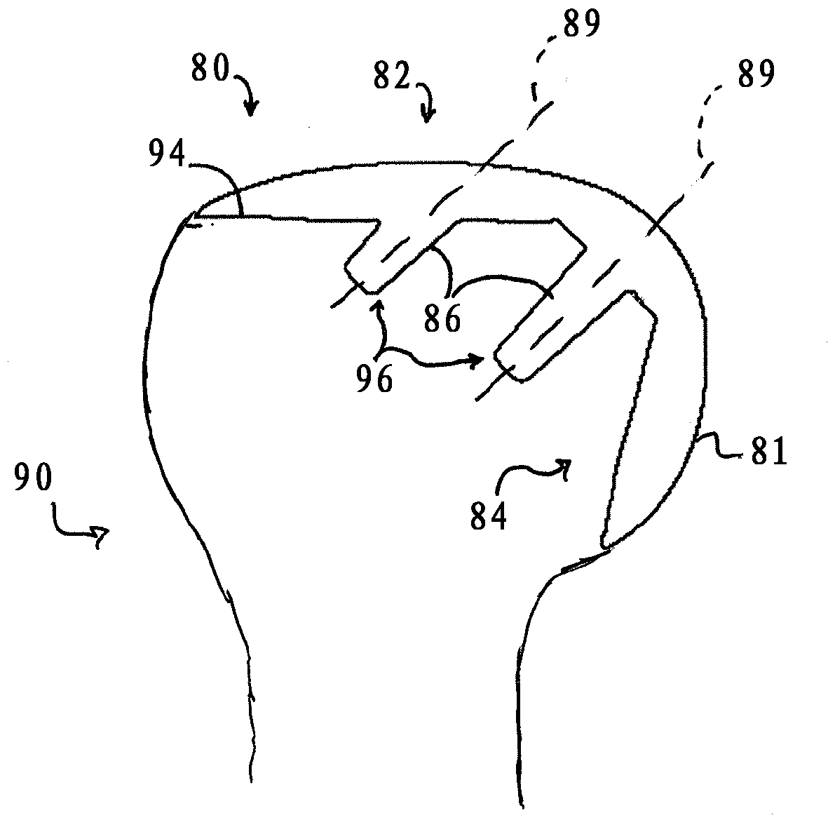 Adjustable position trial component with drill guide