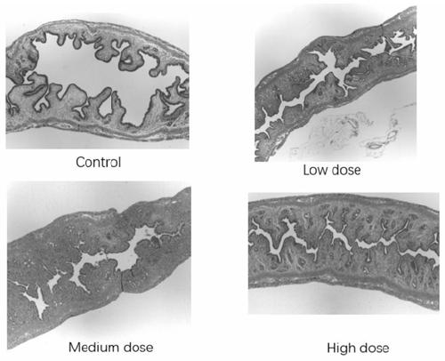 Compound medicine for improving gynecological reproductive endocrine diseases and preparation method of compound medicine