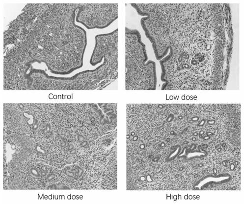 Compound medicine for improving gynecological reproductive endocrine diseases and preparation method of compound medicine