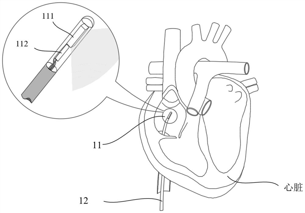 Intracardiac multi-mode ultrasonic imaging method, device and system