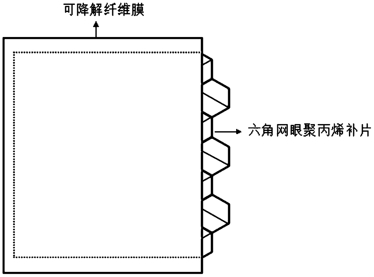 A kind of polylactic acid/polycaprolactone/polypropylene composite pelvic floor patch and preparation method thereof