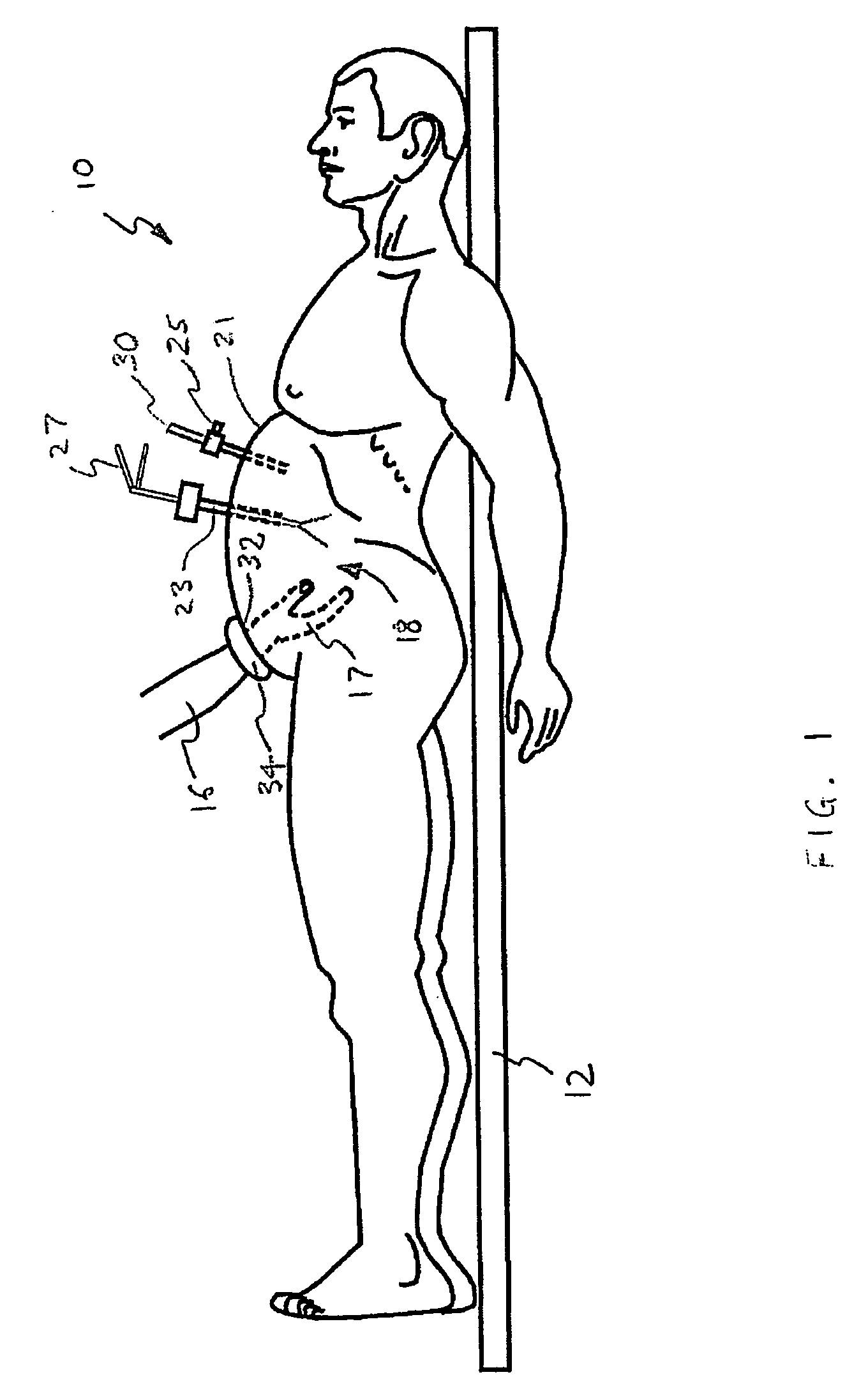 Surgical access system