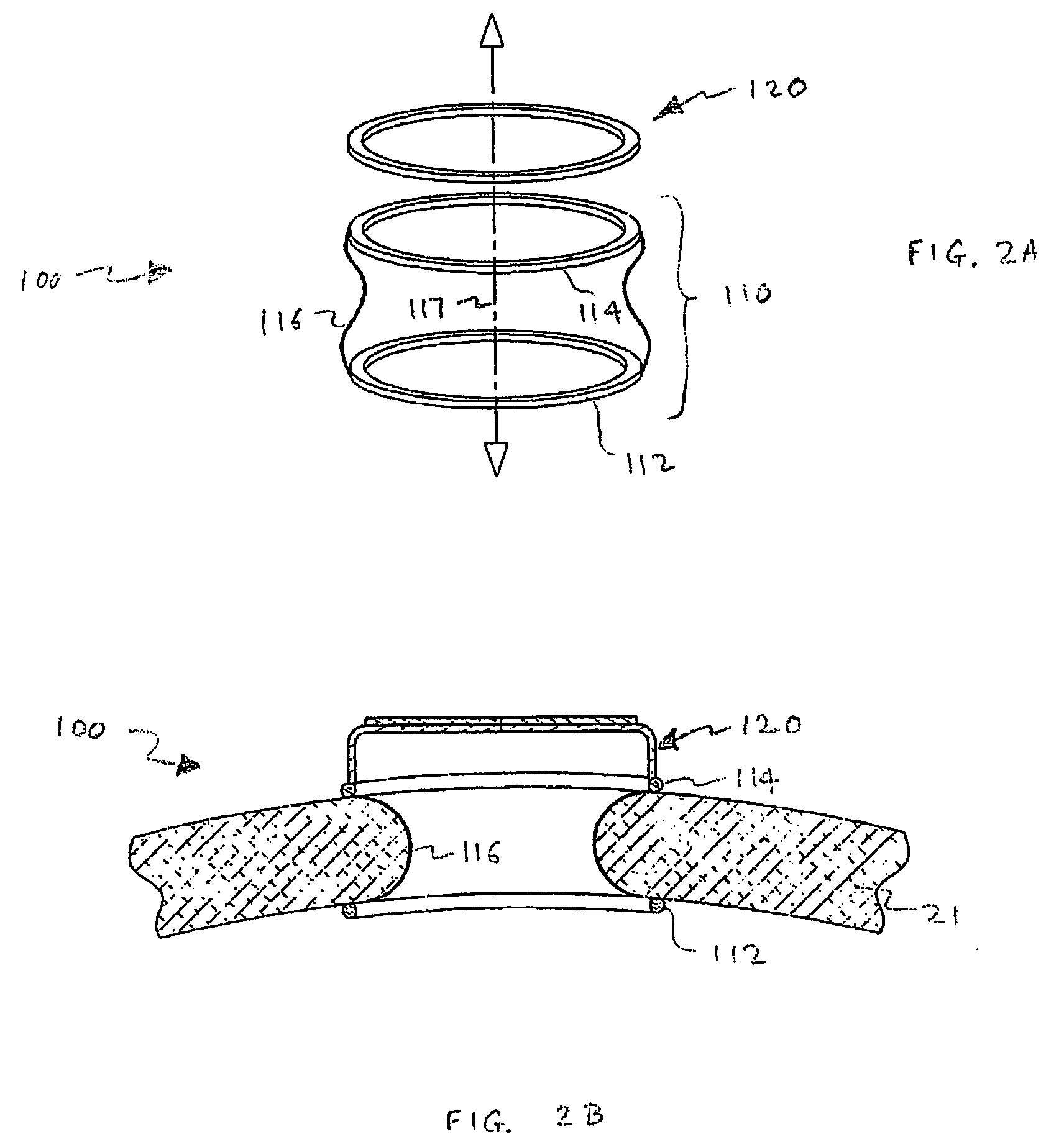 Surgical access system