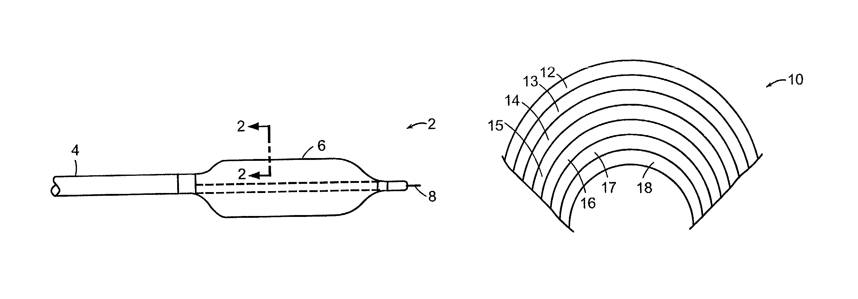 Multilayer medical device