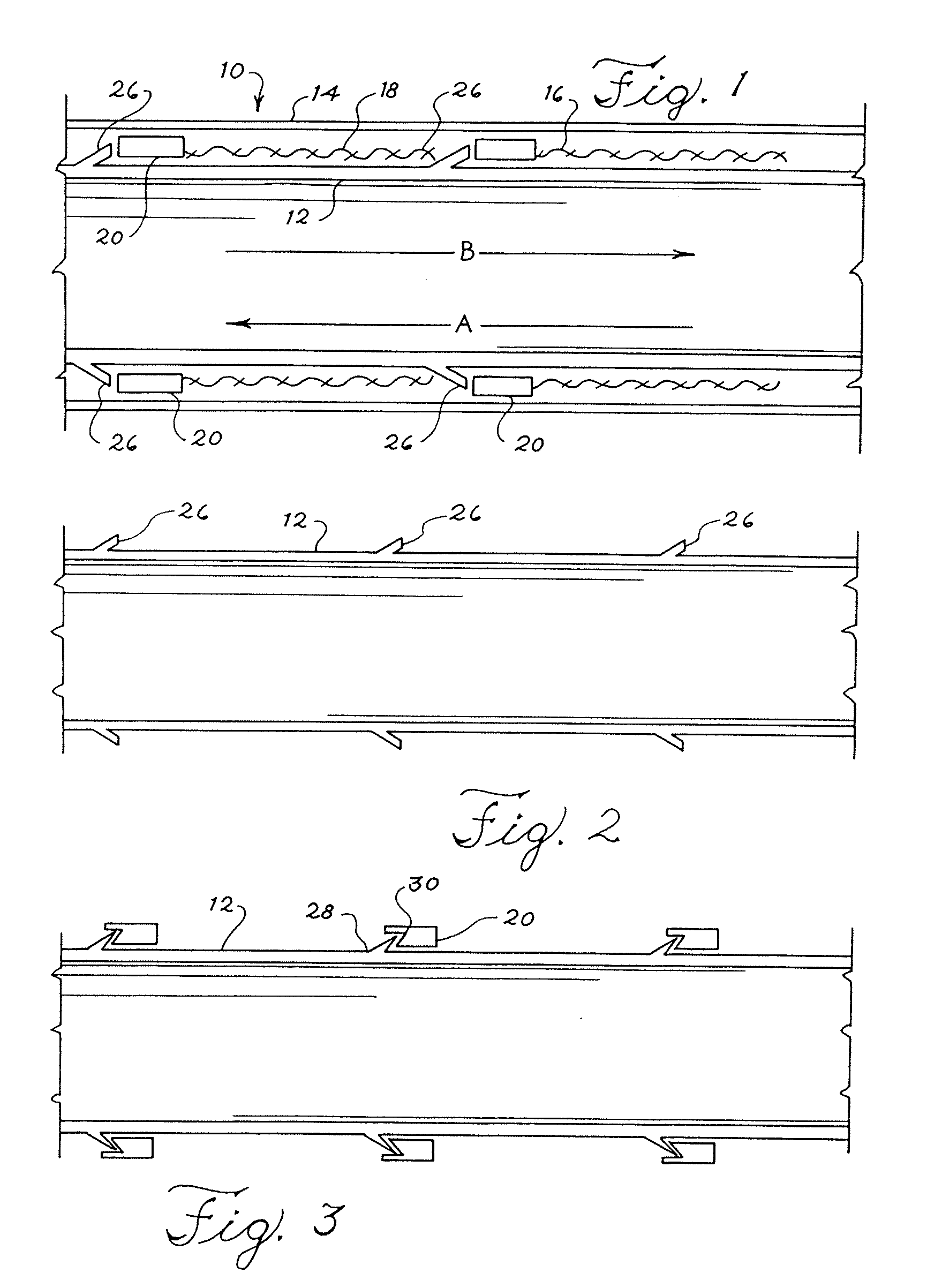 Sequential implant delivery system