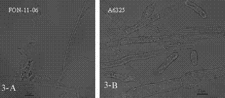 Watermelon oxysporum pathogenic FonAGL3 gene as well as deleted DNA fragment, deletion mutant and application thereof